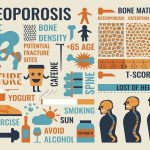 Ernährung bei Osteoporose